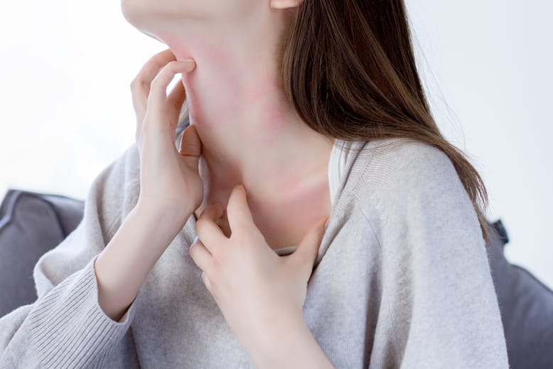 Read more about the article Your Everyday Guide to Living Well With Atopic Dermatitis (Eczema)