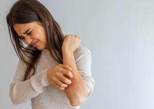 Eczema on Womans Arm