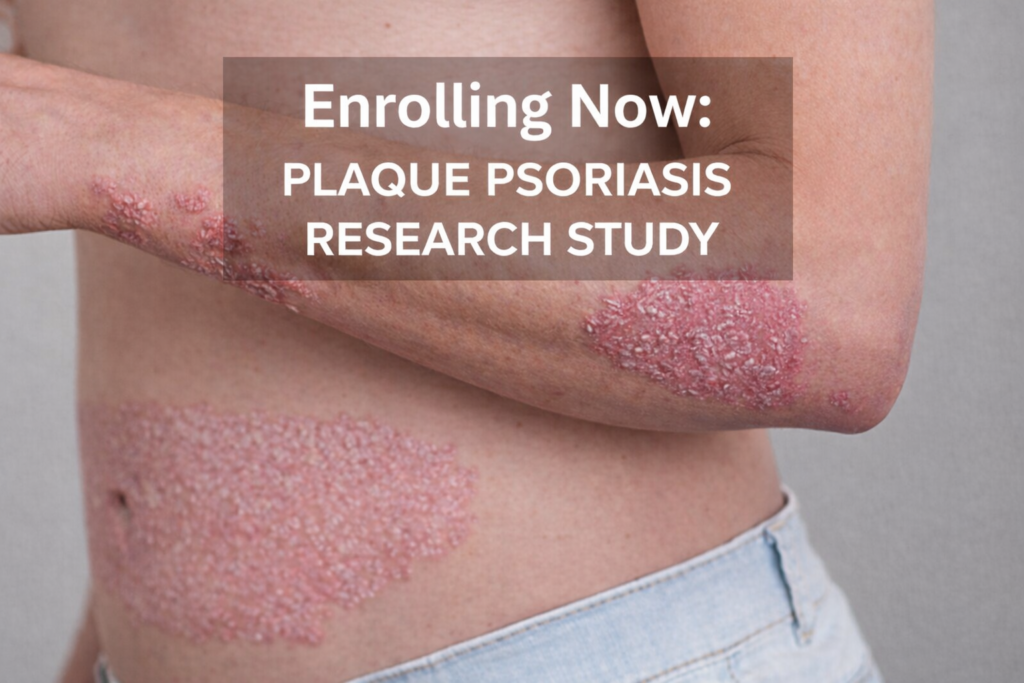 plaque psoriasis clinical trial